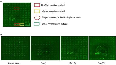 Babesia microti Protein BmSP44 Is a Novel Protective Antigen in a Mouse Model of Babesiosis